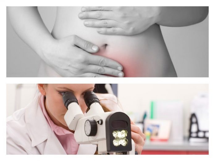 cervix uterino